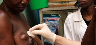 cancer-du-sein-tout-sur-les-symptomes-et-les-facteurs-de-risque